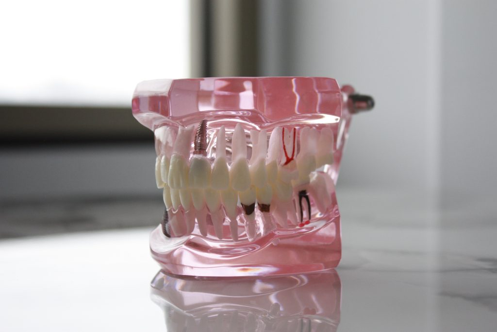 picture of teeth model